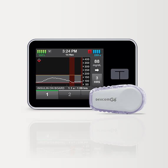 Tandem T: Slim X2 Insulin Pump with Basal-IQ Technology
