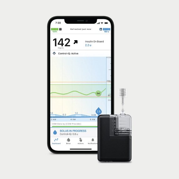Buy Tandem Mobi Insulin Pump | Dexcom G7 & G6 Compatible